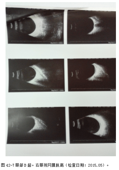 ZY016_235_1.gif